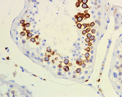 IHC of paraffin-embedded human testis tissue using anti-CD168 / RHAMM antibody.