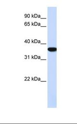 HepG2 cell lysate. Antibody concentration: 1.0 ug/ml. Gel concentration: 12%.