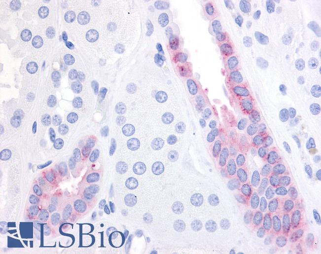 Anti-GPR1 antibody LS-A4164 IHC of human kidney. Immunohistochemistry of formalin-fixed, paraffin-embedded tissue after heat-induced antigen retrieval.
