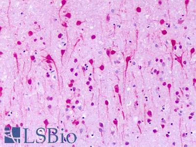Anti-GPR1 antibody IHC of human brain, neurons. Immunohistochemistry of formalin-fixed, paraffin-embedded tissue after heat-induced antigen retrieval. Antibody LS-A74 dilution 32 ug/ml.