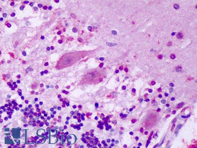 Anti-GPR1 antibody IHC of human brain, cerebellum, Purkinje neurons. Immunohistochemistry of formalin-fixed, paraffin-embedded tissue after heat-induced antigen retrieval. Antibody LS-A74 dilution 32 ug/ml.