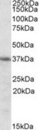 HMOX2 antibody (0.3 ug/ml) staining of K562 cell lysate (35 ug protein/ml in RIPA buffer). Primary incubation was 1 hour. Detected by chemiluminescence.