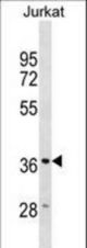 HMOX2 Antibody western blot of Jurkat cell line lysates (35 ug/lane). The HMOX2 antibody detected the HMOX2 protein (arrow).