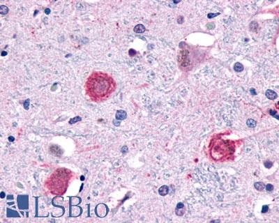 Anti-GPR1 antibody LS-A76 IHC of human brain, neurons and glia. Immunohistochemistry of formalin-fixed, paraffin-embedded tissue after heat-induced antigen retrieval.