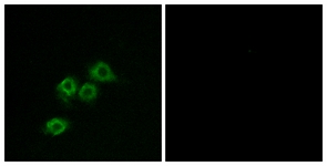 Immunofluorescence of MCF7 cells, using GPR1 Antibody. The sample on the right was incubated with synthetic peptide.