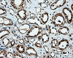IHC of paraffin-embedded Kidney tissue using anti-MTRF1L mouse monoclonal antibody. (Dilution 1:50).