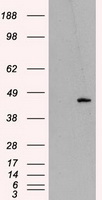 HEK293T cells were transfected with the pCMV6-ENTRY control (Left lane) or pCMV6-ENTRY MTRF1L (Right lane) cDNA for 48 hrs and lysed. Equivalent amounts of cell lysates (5 ug per lane) were separated by SDS-PAGE and immunoblotted with anti-MTRF1L.