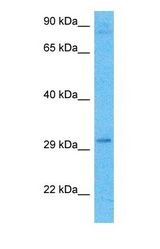 Western blot of HNMT Antibody with human 786-0 Whole Cell lysate.