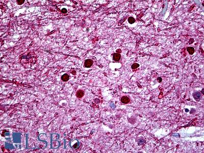 Anti-HMX2 antibody IHC of human brain, cortex. Immunohistochemistry of formalin-fixed, paraffin-embedded tissue after heat-induced antigen retrieval. Antibody LS-B5422 concentration 5 ug/ml.