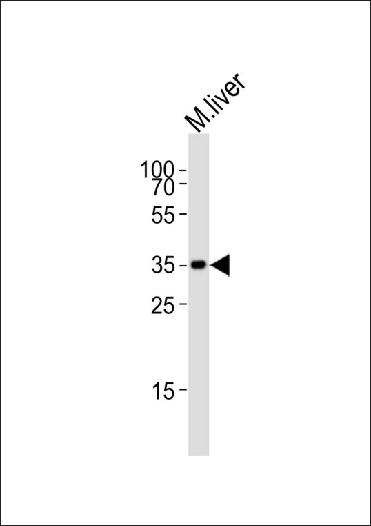 Western blot of lysate from mouse liver tissue lysate, using Hmx2 Antibody. Antibody was diluted at 1:1000. A goat anti-rabbit IgG H&L (HRP) at 1:10000 dilution was used as the secondary antibody. Lysate at 20ug.