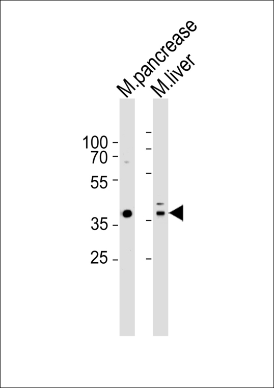 Western blot of lysates from mouse pancreas and mouse liver tissue (from left to right), using Hmx3 (Mouse C-term). Antibody was diluted at 1:1000 at each lane. A goat anti-rabbit IgG H&L (HRP) at 1:5000 dilution was used as the secondary antibody. Lysates at 35ug per lane.