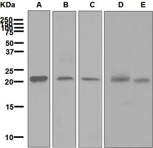 Western blot analysis on (A) HepG2, (B) human testis, (C) HeLa, (D) fetal muscle, and (E) human thymus lysates using anti-HN1 antibody.