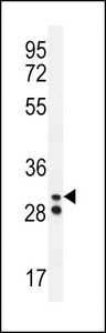 Neutrophil elastase Antibody western blot of A2058 cell line lysates (35 ug/lane). The Neutrophil elastase antibody detected the Neutrophil elastase protein (arrow).
