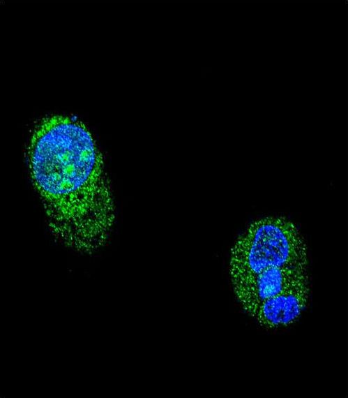 Confocal immunofluorescent of HNF1A Antibody with HepG2 cell followed by Alexa Fluor 488-conjugated goat anti-rabbit lgG (green). DAPI was used to stain the cell nuclear (blue).