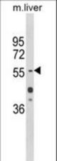 Western blot of HNF1A Antibody in mouse liver tissue lysates (35 ug/lane). HNF1A (arrow) was detected using the purified antibody.