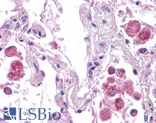 Anti-HNF1A / TCF1 antibody IHC of human lung. Immunohistochemistry of formalin-fixed, paraffin-embedded tissue after heat-induced antigen retrieval. Antibody LS-B4676 concentration 5 ug/ml.
