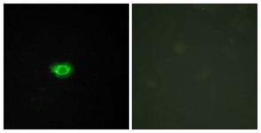 Immunofluorescence of HUVEC cells, using GPR108 Antibody. The picture on the right is treated with the synthesized peptide.