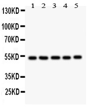 HNF-4-alpha antibody Western blot. All lanes: Anti HNF-4-alpha at 0.5 ug/ml. Lane 1: Rat Liver Tissue Lysate at 50 ug. Lane 2: Rat Kidney Tissue Lysate at 50 ug. Lane 3: RH35 Whole Cell Lysate at 40 ug. Lane 4: HELA Whole Cell Lysate at 40 ug. Lane 5: HEPG2 Whole Cell Lysate at 40 ug. Predicted band size: 53 kD. Observed band size: 53 kD.