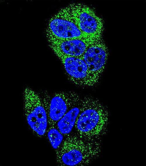 Confocal immunofluorescent of HNF4A Antibody with MCF-7 cell followed by Alexa Fluor 488-conjugated goat anti-rabbit lgG (green). DAPI was used to stain the cell nuclear (blue).