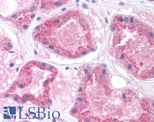 Anti-HNF4A / HNF4 antibody IHC of human kidney. Immunohistochemistry of formalin-fixed, paraffin-embedded tissue after heat-induced antigen retrieval. Antibody LS-B969 concentration 5 ug/ml.