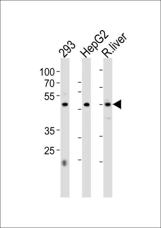 HNF4A Antibody western blot of 293,HepG2 cell line and rat liver tissue lysates (35 ug/lane). The HNF4A antibody detected the HNF4A protein (arrow).