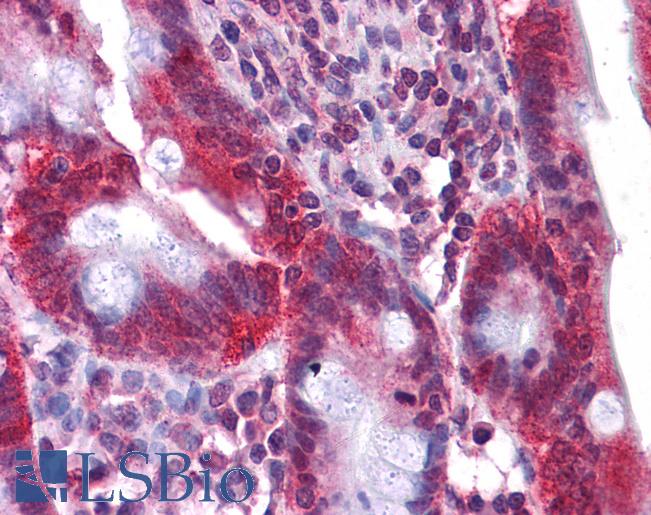 Anti-HNF4A / HNF4 antibody IHC of human small intestine. Immunohistochemistry of formalin-fixed, paraffin-embedded tissue after heat-induced antigen retrieval. Antibody LS-B4568 concentration 5 ug/ml.