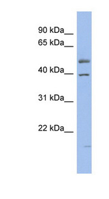 HNF4A / HNF4 antibody LS-B4568 Western blot of OVCAR-3 cell lysate.