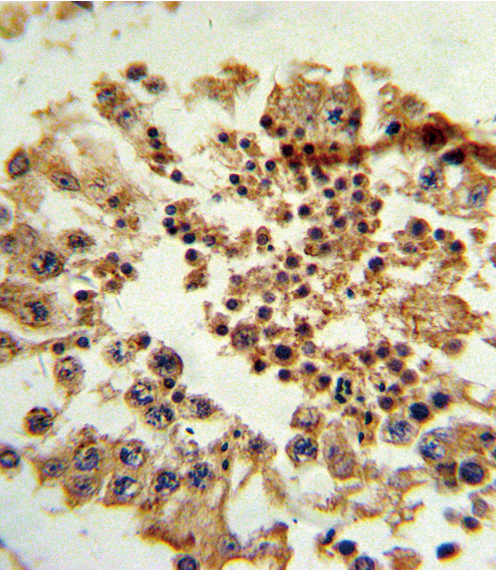 Formalin-fixed and paraffin-embedded human testis tissue reacted with HNF4G Antibody , which was peroxidase-conjugated to the secondary antibody, followed by DAB staining. This data demonstrates the use of this antibody for immunohistochemistry; clinical relevance has not been evaluated.