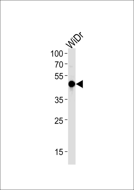 HNF4G Antibody western blot of WiDr cell line lysates (35 ug/lane). The HNF4G antibody detected the HNF4G protein (arrow).