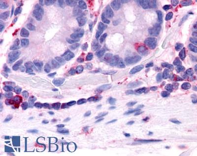 Anti-HNF4G antibody LS-A5160 IHC of human small intestine. Immunohistochemistry of formalin-fixed, paraffin-embedded tissue after heat-induced antigen retrieval.