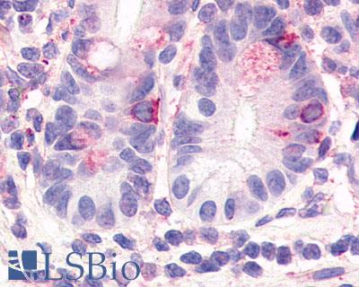 Anti-HNF4G antibody LS-A5162 IHC of human small intestine. Immunohistochemistry of formalin-fixed, paraffin-embedded tissue after heat-induced antigen retrieval.