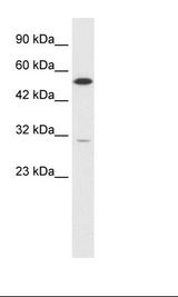 Daudi Cell Lysate