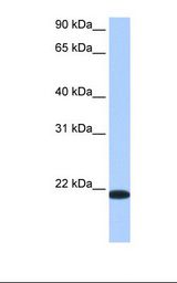 Liver cell lysate. Antibody concentration: 0.5 ug/ml. Gel concentration: 12%.