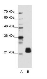 B: HepG2 Cell Lysate