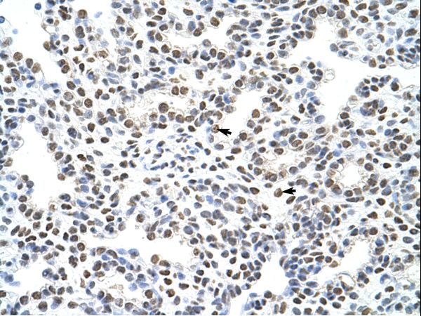 HNRNPA3 / HNRPA3 antibody LS-C30906 was used in IHC to stain formalin-fixed, paraffin-embedded human lung.