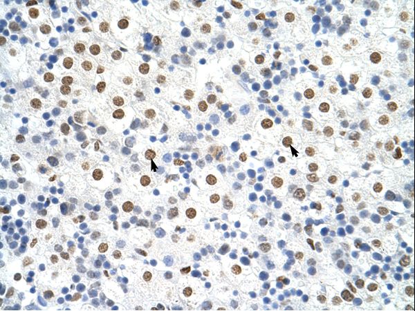 HNRNPA3 / HNRPA3 antibody LS-C30906 was used in IHC to stain formalin-fixed, paraffin-embedded human liver.