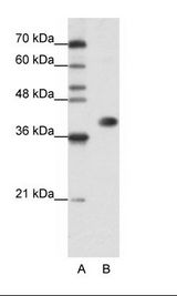 A: Marker, B: Jurkat Cell Lysate