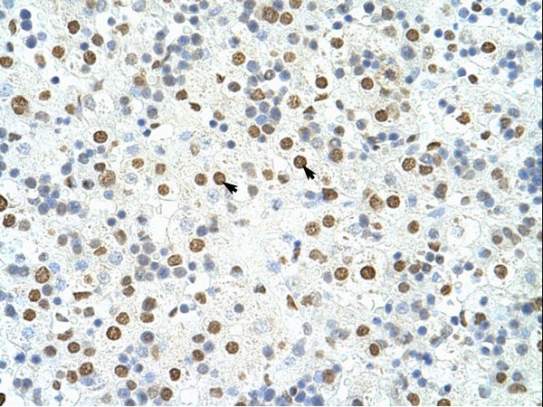 HNRNPA3 / HNRPA3 antibody LS-C30903 was used in IHC to stain formalin-fixed, paraffin-embedded human liver.