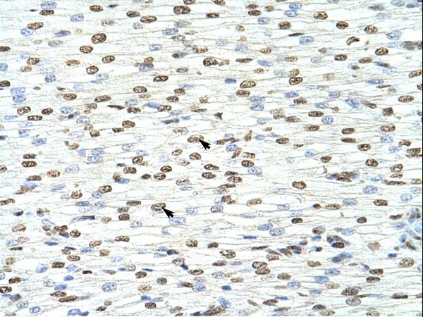 HNRNPA3 / HNRPA3 antibody LS-C30903 was used in IHC to stain formalin-fixed, paraffin-embedded human heart.