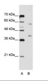 A: Marker, B: Jurkat Cell Lysate