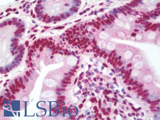 Anti-HNRNPA3 / HnRNP A3 antibody IHC staining of human small intestine. Immunohistochemistry of formalin-fixed, paraffin-embedded tissue after heat-induced antigen retrieval. Antibody LS-B10693 dilution 1:75.