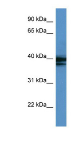 HNRNPAB / HNRPAB antibody LS-C135101 Western blot of COLO205 cell lysate.