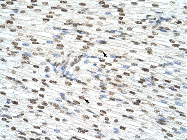 HNRNPAB / HNRPAB antibody LS-C31560 was used in IHC to stain formalin-fixed, paraffin-embedded human heart.