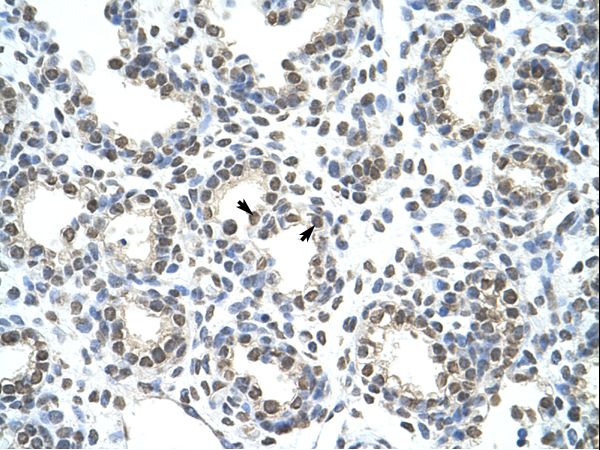 HNRNPAB / HNRPAB antibody LS-C31560 was used in IHC to stain formalin-fixed, paraffin-embedded human lung.