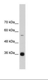 Daudi Cell Lysate