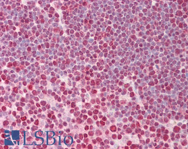 Anti-HNRNPC / HNRPC antibody IHC of human thymus. Immunohistochemistry of formalin-fixed, paraffin-embedded tissue after heat-induced antigen retrieval. Antibody LS-B7668 concentration 10 ug/ml.