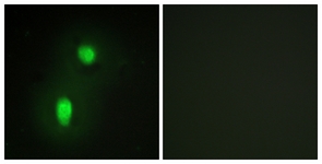 Immunofluorescence of HUVEC cells, using hnRNP C1/C2 Antibody. The picture on the right is treated with the synthesized peptide.