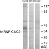 Western blot of extracts from HepG2/COLO205 cells, using hnRNP C1/C2 Antibody. The lane on the right is treated with the synthesized peptide.