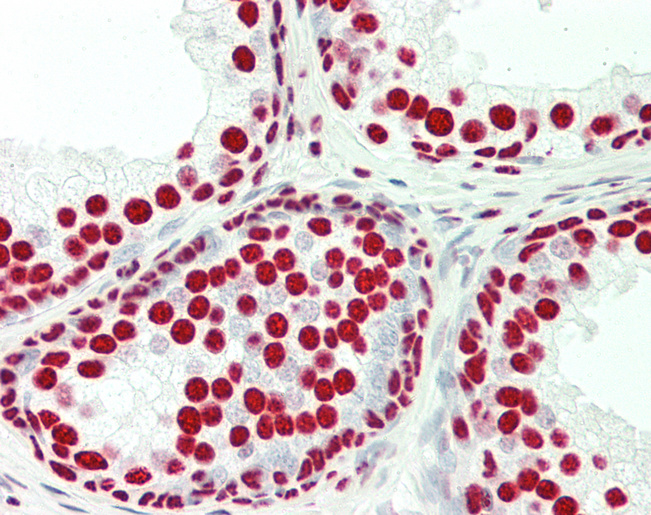 Human Prostate: Formalin-Fixed, Paraffin-Embedded (FFPE)
