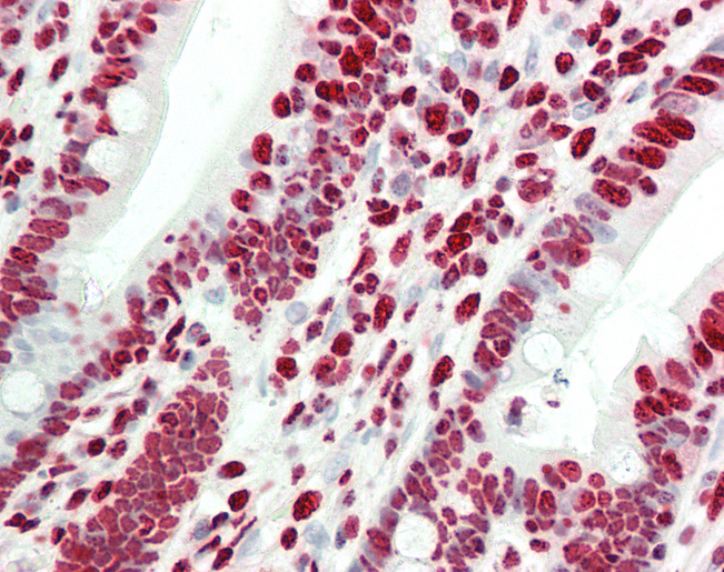 Human Small Intestine: Formalin-Fixed, Paraffin-Embedded (FFPE)